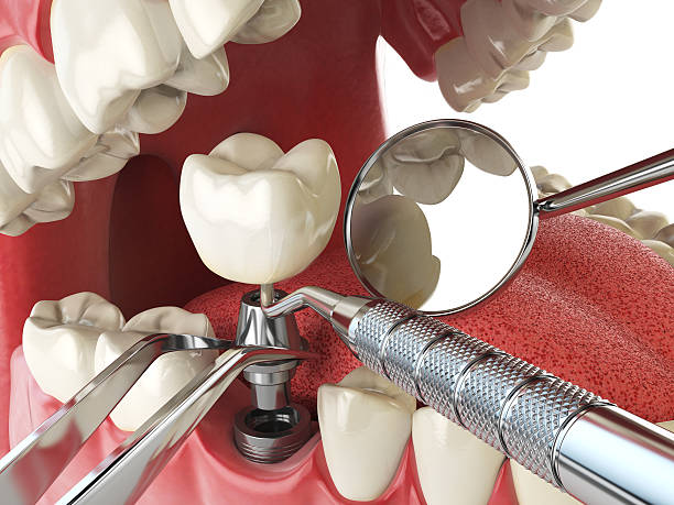  Potomac Mills, VA Emergency Dentist Pros
